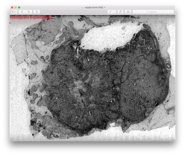 histogram-equalization.png