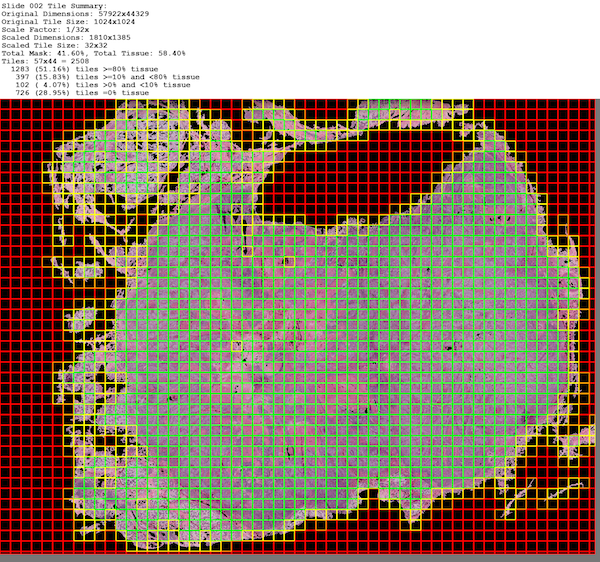 slide-2-tile-tissue-heatmap.png