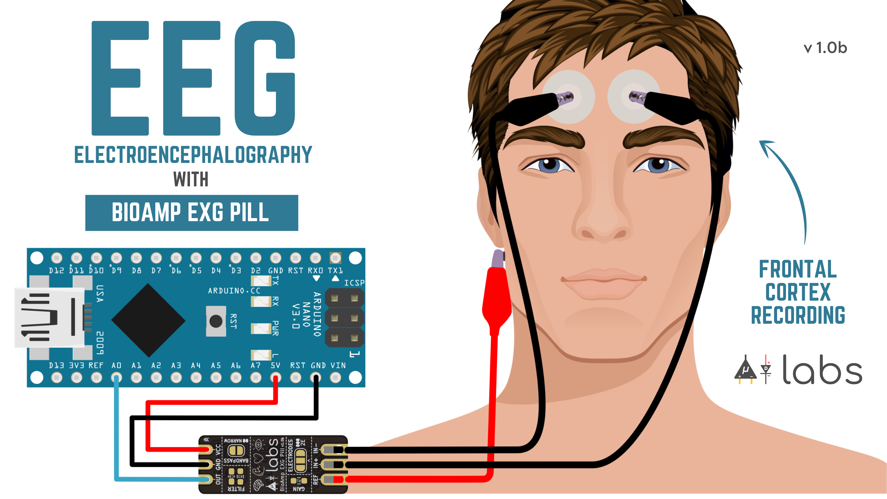 Electroencephalography.png