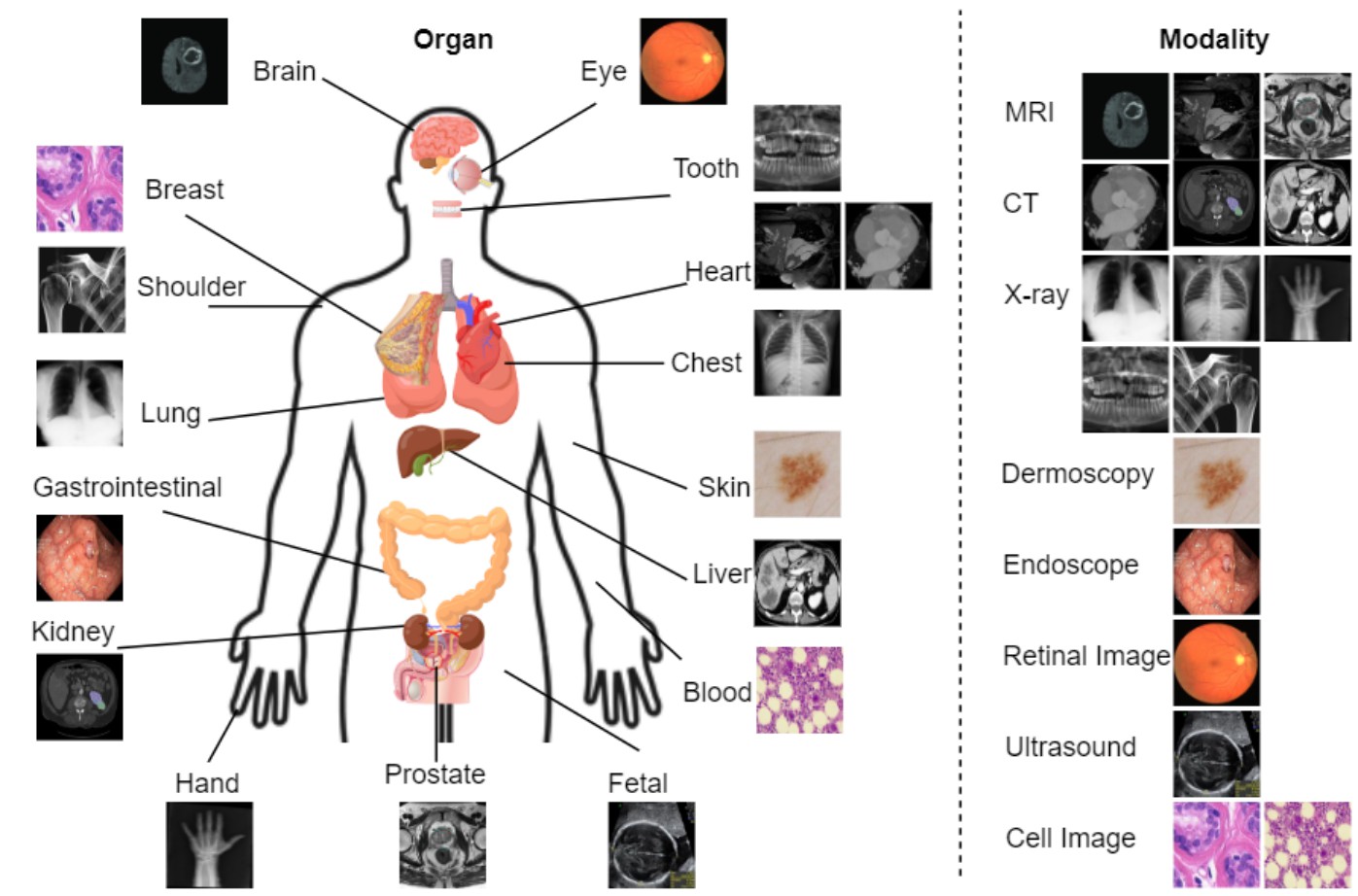 body_lvm_med.jpg