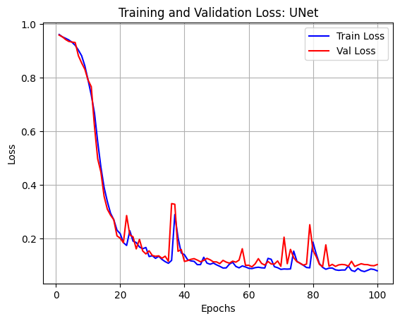 unet_loss.png