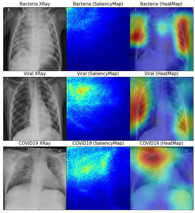 DenseNet121-visualization-0.png